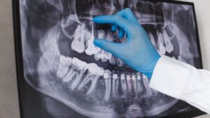 dental x-rays